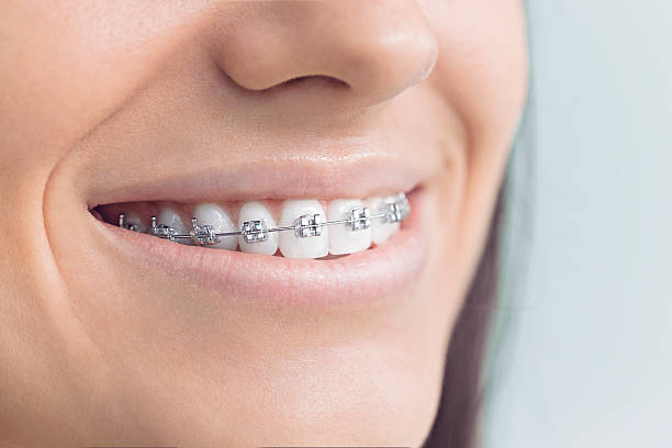 Best Invisalign and Clear Aligners  in Edwardsburg, MI